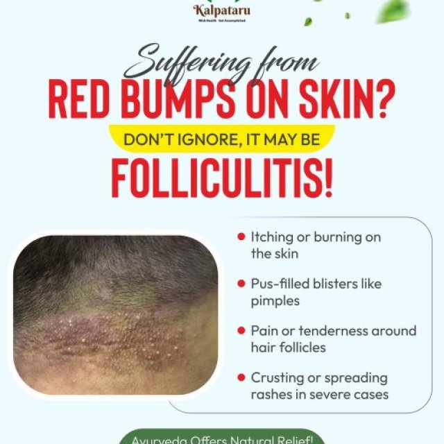 Kalpataru Ayurvediya Chikitsalaya™ | Ayurvedic Doctor In Pune | Psoriasis Treatment | Skin Treatment | Back Pain | Arthritis