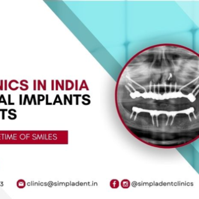 Strategic Dental Implants